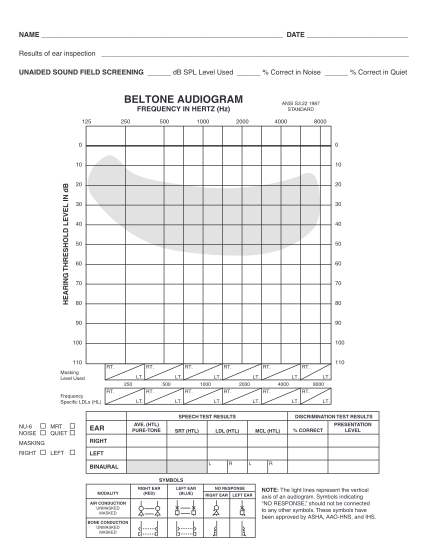 28039640-fillable-blank-audiogram-template-download-form-idph-state-il